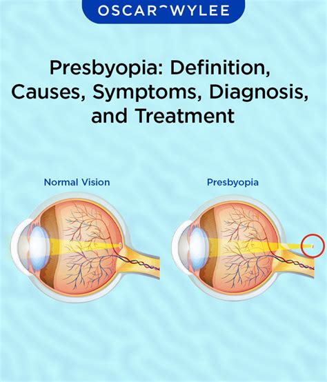 A Life Changing Solution for Presbyopia: Unlocking the Benefits of Seeing Clearly with a Geriatric Optometrist